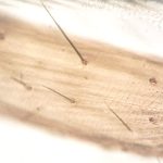 頭皮護理療程的重要性與科學解釋