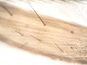 頭皮護理療程的重要性與科學解釋