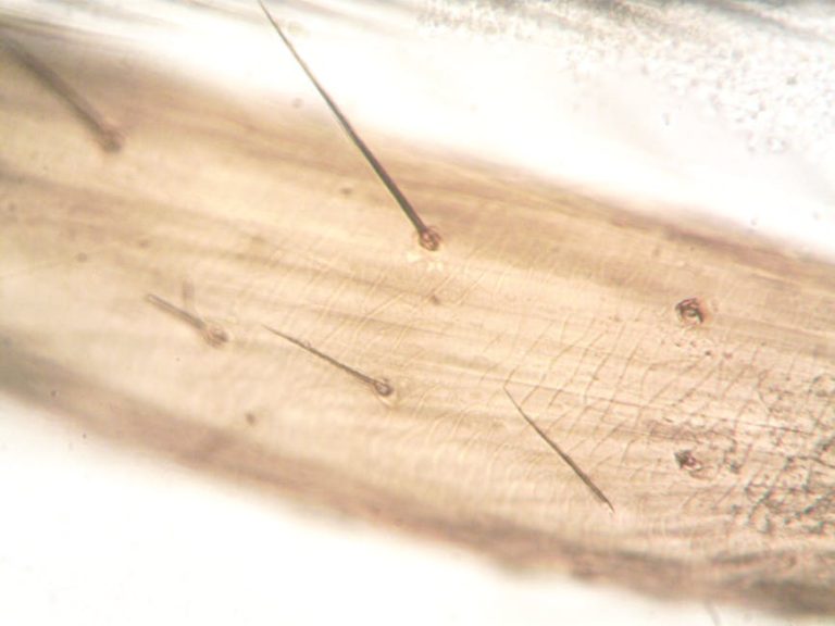 頭皮護理療程的重要性與科學解釋